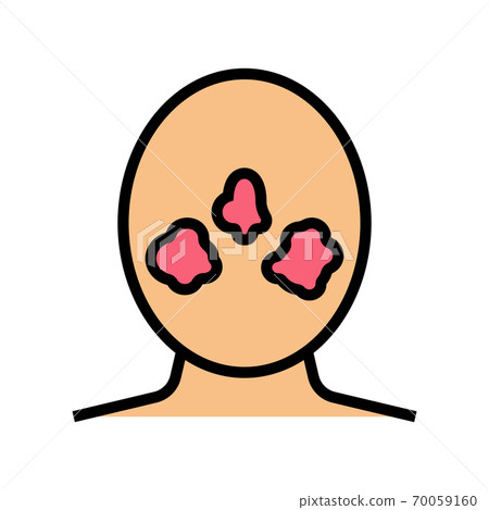 rosacea skin disease color icon vector illustration rosacea skin disease color icon vector illustration 70059160