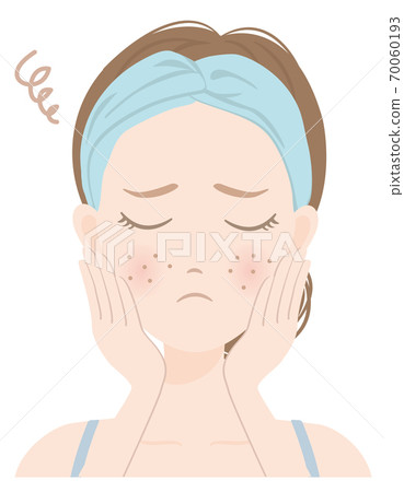 Women's skin care A_15 Women suffering from rough skin 70060193