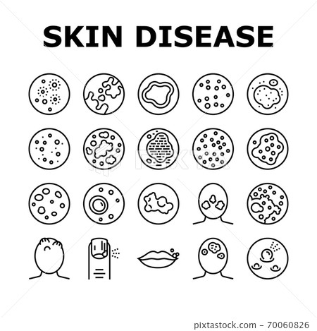 Skin Disease Symptom Collection Icons Set Vector 70060826