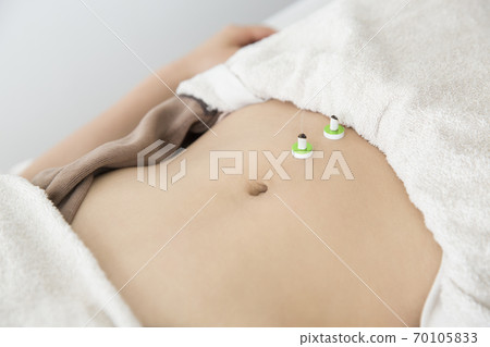 Image of acupuncture and moxibustion 70105833