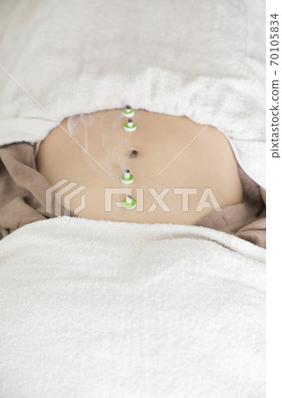 Image of acupuncture and moxibustion Image of acupuncture and moxibustion 70105834