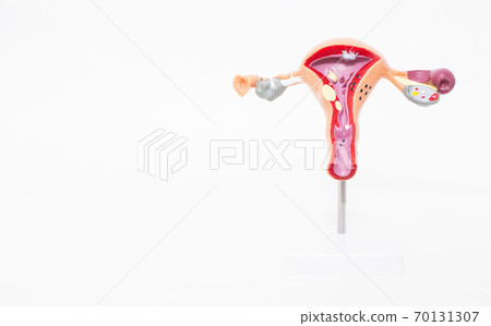 Mock female reproductive system on a white background. The concept of sexually transmitted infections, bacterial vaginosis. Copy space 70131307