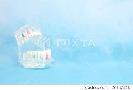 Dental jaw model on a blue background with ozone. Treatment of dental pulpitis and caries. A painless way to treat teeth and oral cavity, copy space for text Dental jaw model on a blue background with ozone. Treatment of dental pulpitis and caries. A painless way to treat teeth and oral cavity, copy space for text 70137148