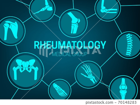 Rheumatology Medicine, Joints X-ray Vector Banner - Stock Illustration 