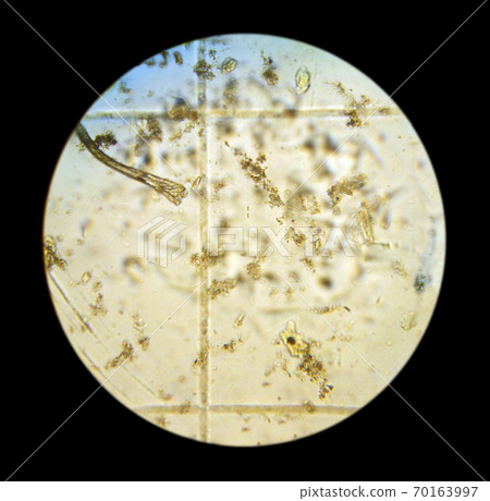 Phytoplankton cells. The picture was taken with an optical microscope by camera. Phytoplankton sample in Russia, Primorsky Krai, Sea of Japan, Vostok Bay, 2009 70163997