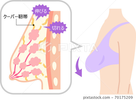 Drooping breast Cooper s ligament female body Stock Illustration