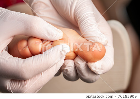 Doctor little girl's foot with fungus infection 70183909