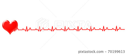 心電圖波形 70199613