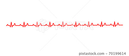 ECG waveform image 70199614