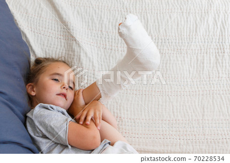 broken leg. Close-up of the cast on the feet. exercises to repair and strengthen muscles. damage to the bones. medical care of a surgeon in the emergency room 70228534