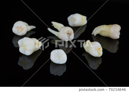 Torn human teeth on a black background. Close-up photo of spoiled molars and premolars. Selective focus. 70258646