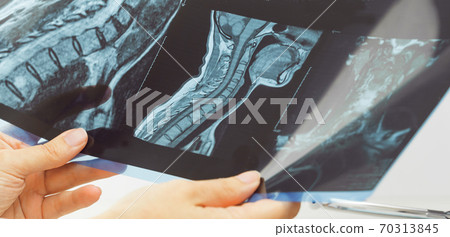 Female doctors hand pointing at x-ray medical imaging at a shoulder condition Female doctors hand pointing at x-ray medical imaging at a shoulder condition 70313845