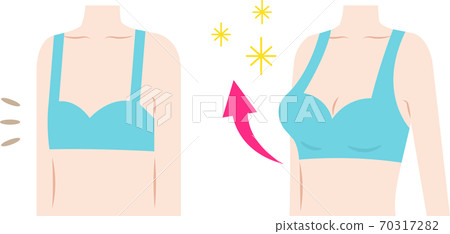 Bust up before after woman's body Bust up before after woman's body 70317282