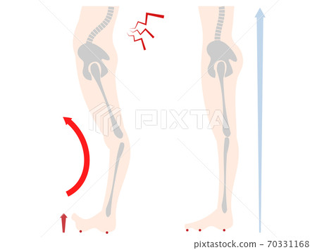 Comparison set of lower body and bone distortion of floating fingers 70331168