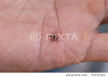 Aedes aegypti that was slapped Aedes aegypti that was slapped 70335462