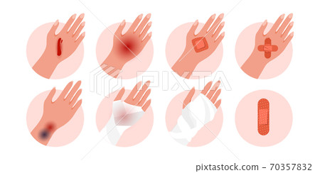 Human body parts of a physical injury with contusion, bruise open cut, wounds, vector Illustration  70357832
