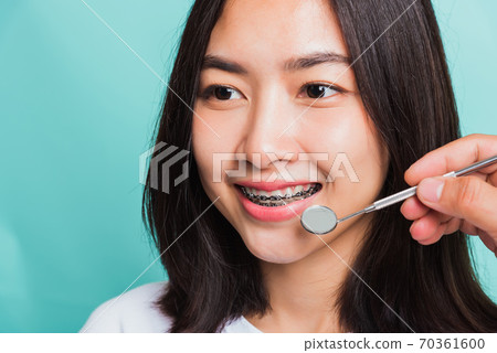 woman smile have dental braces on teeth laughing and have medical equipment tools for check tooth 70361600