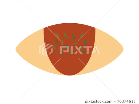 煎蛋捲飯的插圖 70374615