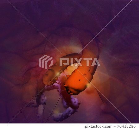 Digital illustration of  cancer cells in human body 70413286