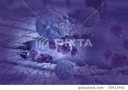 Digital illustration of cancer cells in human body Digital illustration of cancer cells in human body 70413442