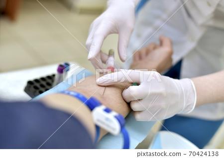 Venous blood sampling. The laboratory assistant holding the vacutainer needle with the attached vacuum tube with hand. Venous blood sampling. The laboratory assistant holding the vacutainer needle with the attached vacuum tube with hand. 70424138