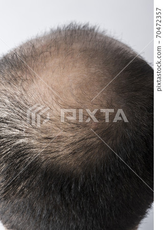 一個瘦頭髮的男人 一個瘦頭髮的男人 70472357