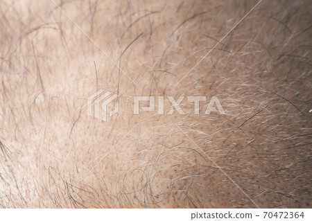 一個瘦頭髮的男人 70472364