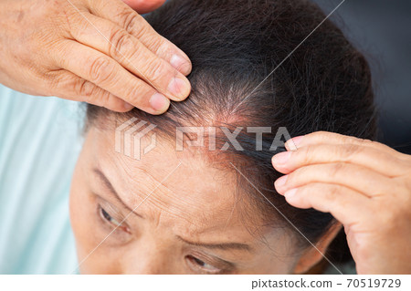 Women who care about their hairline Women who care about their hairline 70519729
