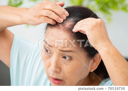 Women who care about their hairline Women who care about their hairline 70519730
