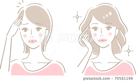 Thin-haired women before and after 70581199