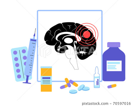 Brain and neurology Brain and neurology 70597016