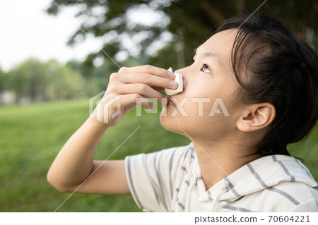 Sick asian child girl using tissue paper for stop bleeding from the nose,female teenage with nosebleed or epistaxis suffer from allergic rhinitis,respiratory or nose injury, bleeding from an accident 70604221
