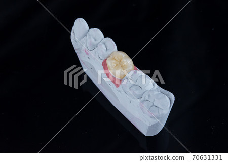 Close up painting artificial dental crown in a dental laboratory. Molar dental crown on gypsum model. 70631331