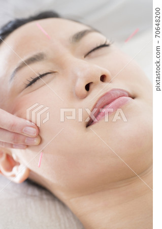 針灸治療 70648200