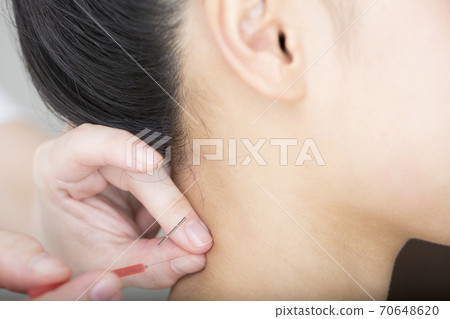 Acupuncture treatment Acupuncture treatment 70648620