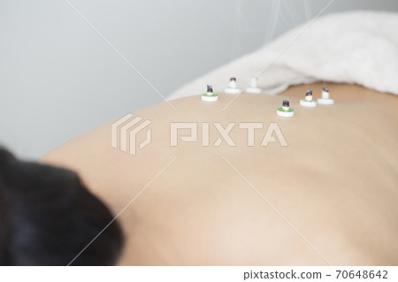 Image of acupuncture and moxibustion Image of acupuncture and moxibustion 70648642