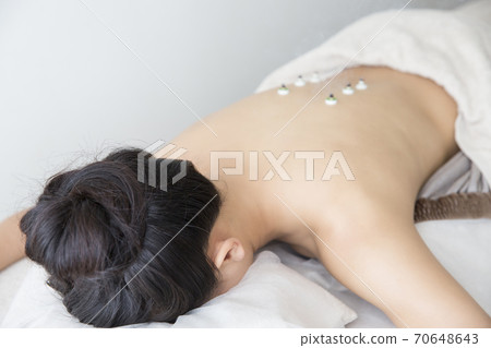 針灸圖片 70648643