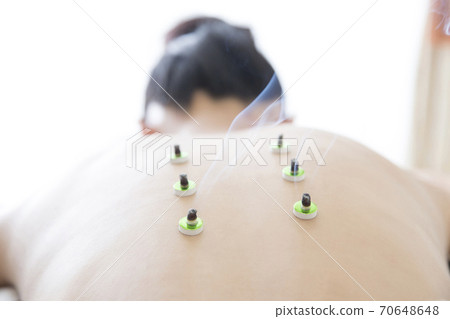 針灸圖片 針灸圖片 70648648