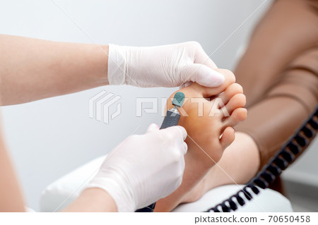 Peeling feet pedicure procedure on foot Peeling feet pedicure procedure on foot 70650458