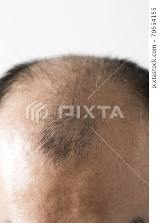一個瘦頭髮的男人 一個瘦頭髮的男人 70654155
