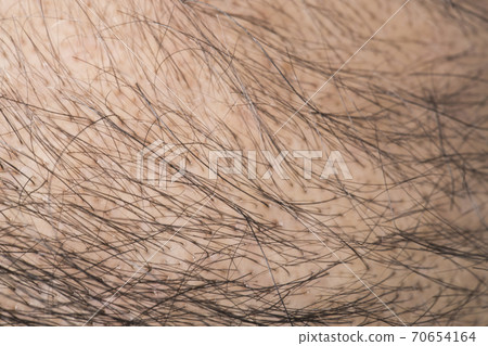 A thin hair man 70654164