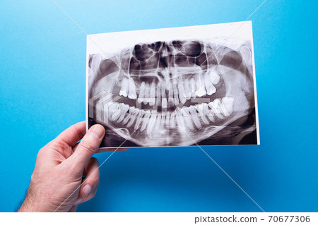 A dentist holding snapshot the patient's tooth and indicates the problem. Panoramic shot of the jaw on a blue isolated background. 70677306