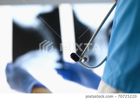 Doctor in protective gloves is holding an X-ray. 70725220