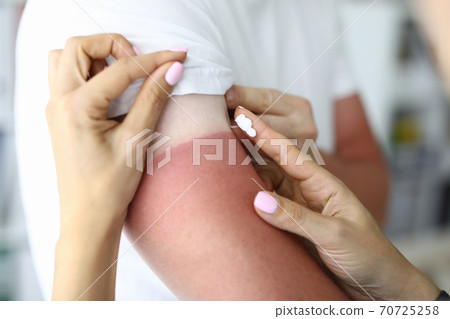 Women's hands apply cream from burns to skin lesions. 70725258