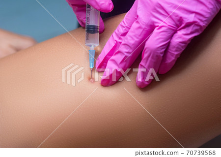 Removal of keloid scars. The beautician gives an injection to renew the skin. 70739568