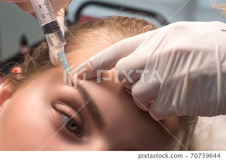 Woman getting cosmetic injection of botulinum near eyes. Crow's feet wrinkles. Eyebrow mesotherapy. Woman getting cosmetic injection of botulinum near eyes. Crow's feet wrinkles. Eyebrow mesotherapy. 70739644