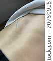 針灸腰 70750915
