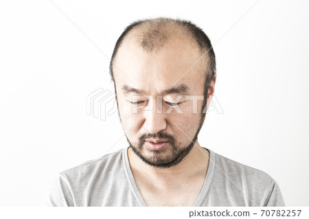 A thin hair man A thin hair man 70782257