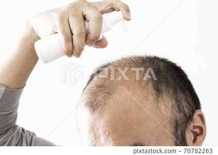 Men doing hair growth spray 70782263