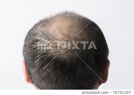 A thin hair man 70782297